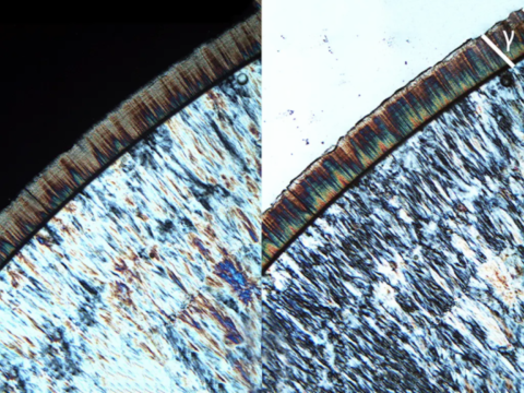 Lussatite sur calcédoine au microscope